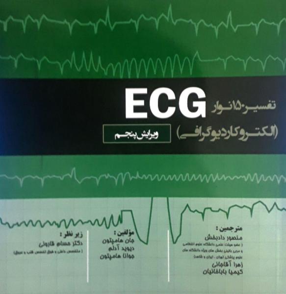 تفسیر ۱۵۰ نوار ECG – الکتروکاردیوگرافی ۲۰۱۹ - قلب و عروق