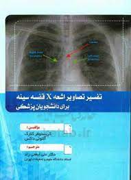  تفسیر تصاویر اشعه X قفسه سینه برای دانشجویان پزشکی - رادیولوژی