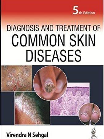  Diagnosis and Treatment of Common Skin Diseases 2016 - پوست