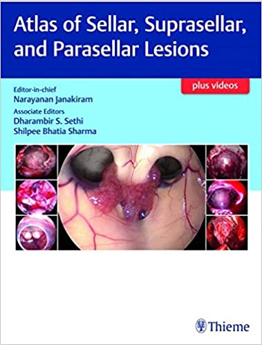 Atlas of Sellar, Suprasellar and Parasellar Lesions+video 2019 - گوش و حلق و بینی