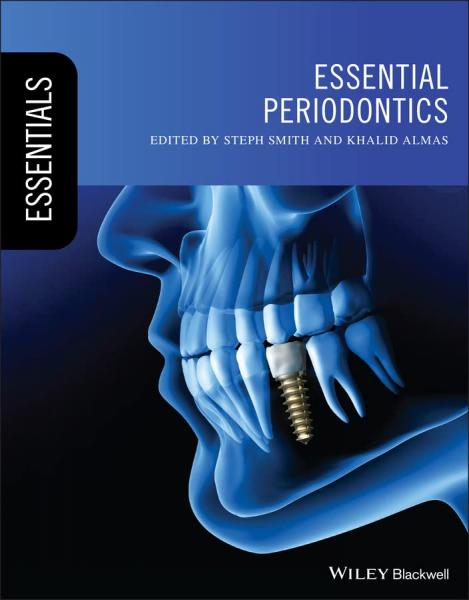 پریودنتیکس ضروری (الزامی (دندانپزشکی)) - دندانپزشکی