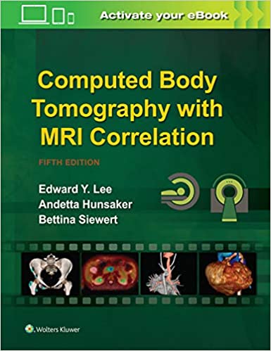 Computed Body Tomography with MRI Correlation 2020 - رادیولوژی