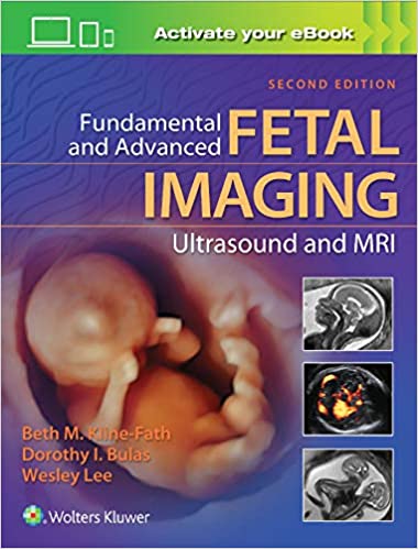 Fundamental and Advanced Fetal Imaging Ultrasound and MRI 2020 - رادیولوژی