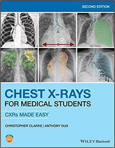 اشعه ایکس قفسه سینه برای دانشجویان پزشکی - رادیولوژی