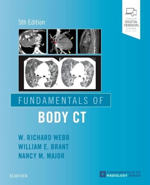 Fundamentals of Body CT (Fundamentals of Radiology)(2022) 5th Edition - رادیولوژی