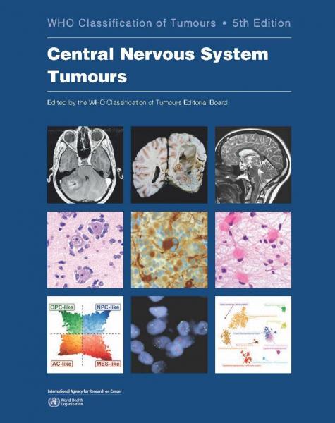 تومورهای سیستم عصبی مرکزی: طبقه بندی تومورهای سازمان جهانی بهداشت - فرهنگ عمومی و لوازم تحریر