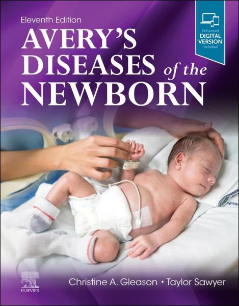 بیماریهای اوریز نوزاد - اطفال