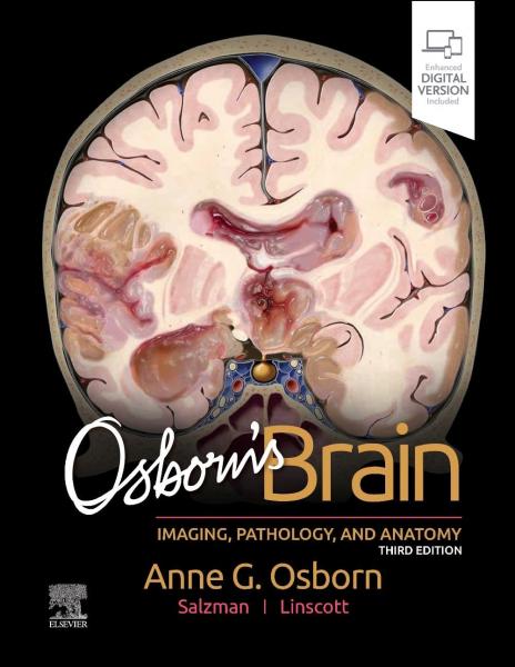 مغز آزبورن - رادیولوژی