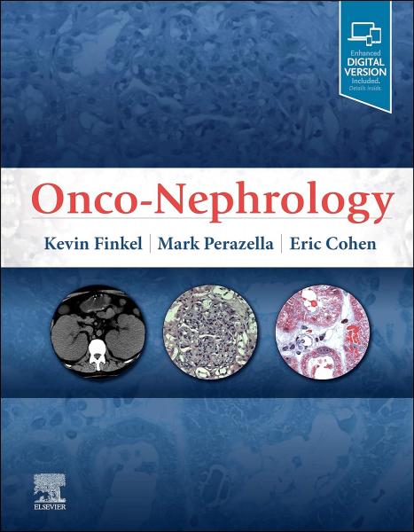 Onco-Nephrology 2020 1st Edition - فرهنگ عمومی و لوازم تحریر