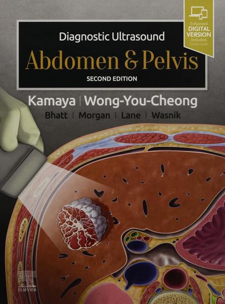 Diagnostic Ultrasound Abdomen and Pelvis 2nd Edition 2022 - رادیولوژی