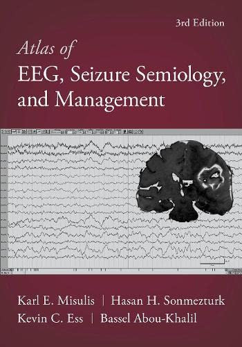Atlas of EEG, Seizure Semiology, and Management 2022 - نورولوژی