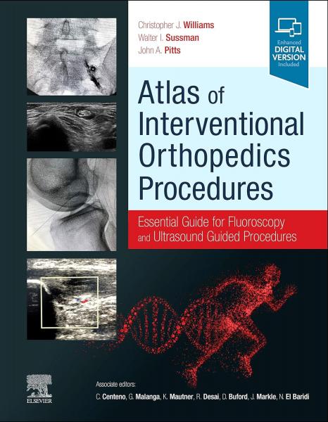  Atlas of Interventional Orthopedics Procedures: Essential Guide for Fluoroscopy and Ultrasound Guided Procedures 2022 - اورتوپدی