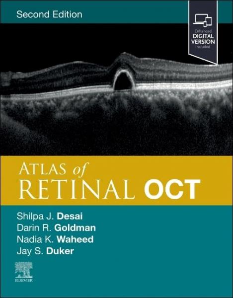 Atlas of Retinal OCT: Optical Coherence Tomography 2024 - چشم