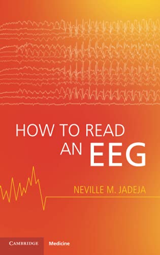 نحوه خواندن EEG - قلب و عروق