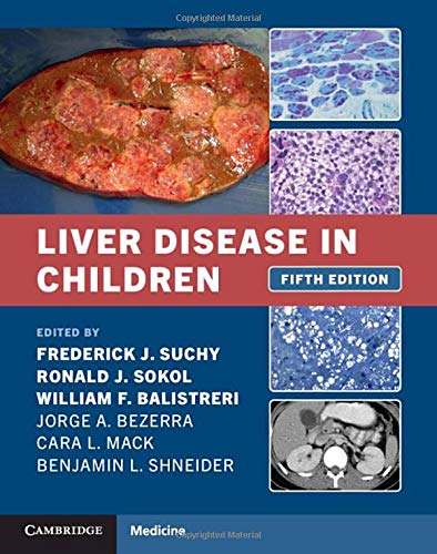 Liver Disease in Children. Suchy 2021 - اطفال