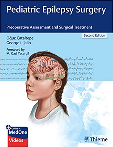 Pediatric Epilepsy Surgery: Preoperative Assessment and Surgical Treatment +Video 2020 - اطفال
