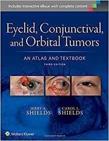 Eyelid, Conjunctival, and Orbital Tumors  2015 - چشم