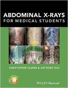 اشعه ایکس ABDOMINAL برای دانشجویان پزشکی - رادیولوژی