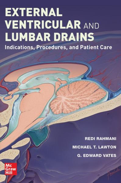 External Ventricular and Lumbar Drains: Indications, Procedures, and Patient Care(2023) 1st Edition - داخلی