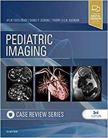 تصویربرداری کودکان: سری بررسی موارد - رادیولوژی